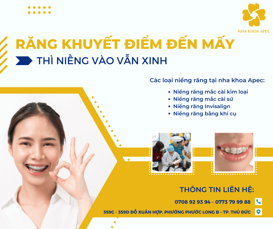 Niềng răng chỉnh nha tại nha khoa Apec