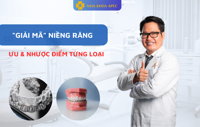 các loại niềng răng và giá