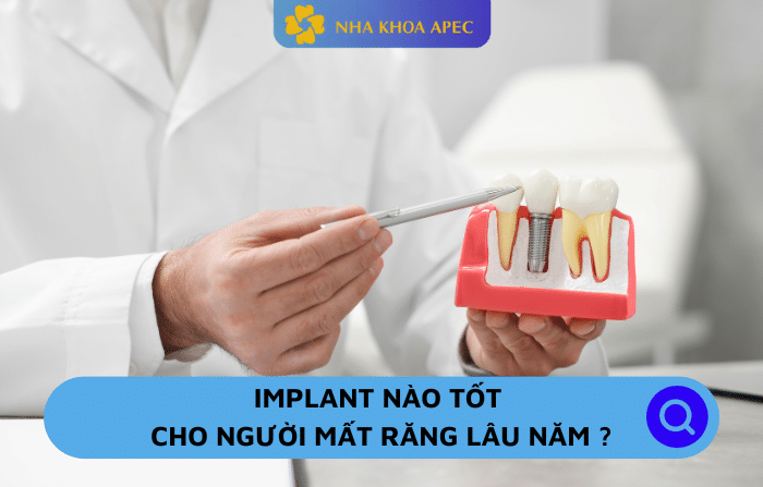 Implant nào tốt cho trường hợp mất răng lâu năm