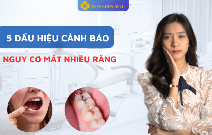 dấu hiệu cảnh báo mất nhiều răng