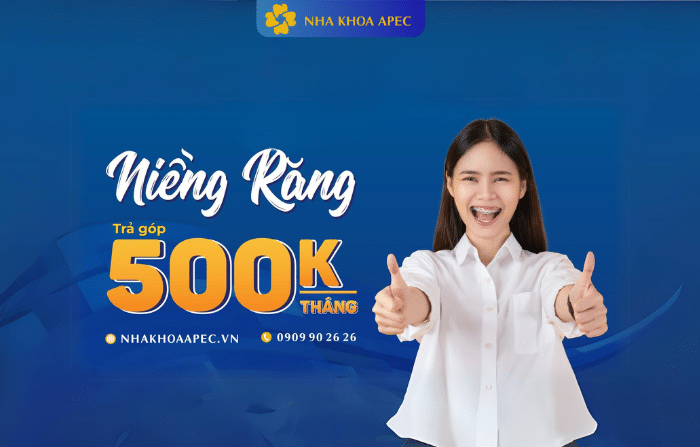 ưu đãi niềng răng giá sinh viên