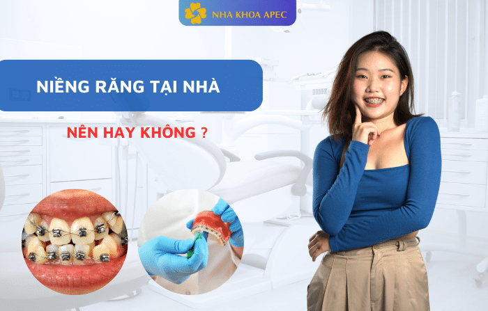 niềng răng tại nhà