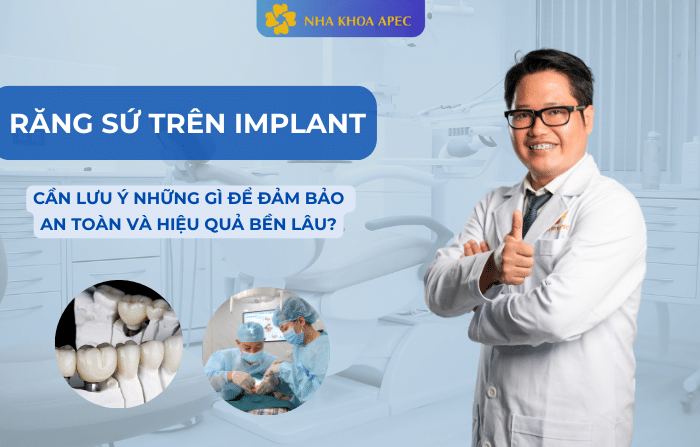 răng sứ trên Implant
