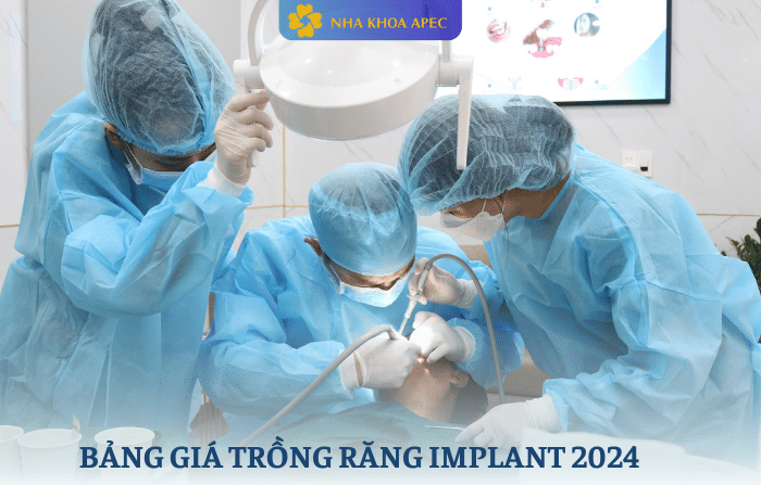 Bảng giá trồng răng Implant
