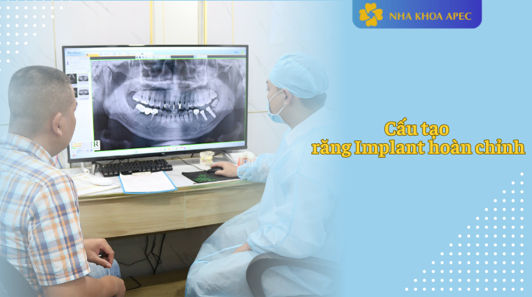 cấu tạo răng implant