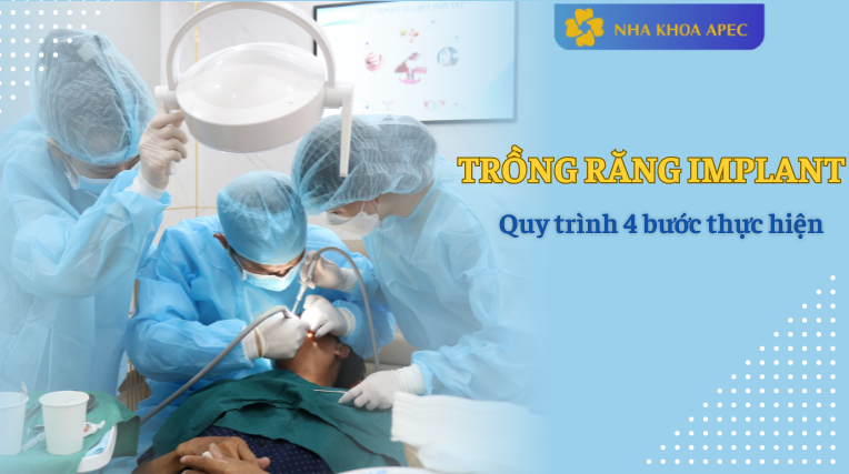 làm răng Implant