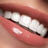 sứ cercon ht