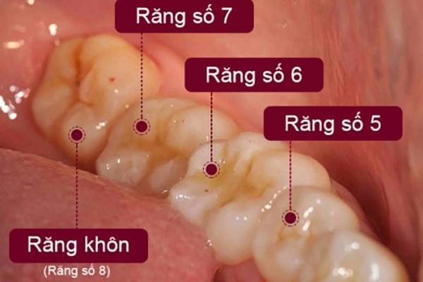 vị trí các răng