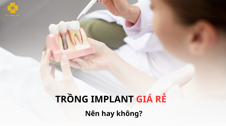 Trồng Implant giá rẻ có đáng tin cậy?
