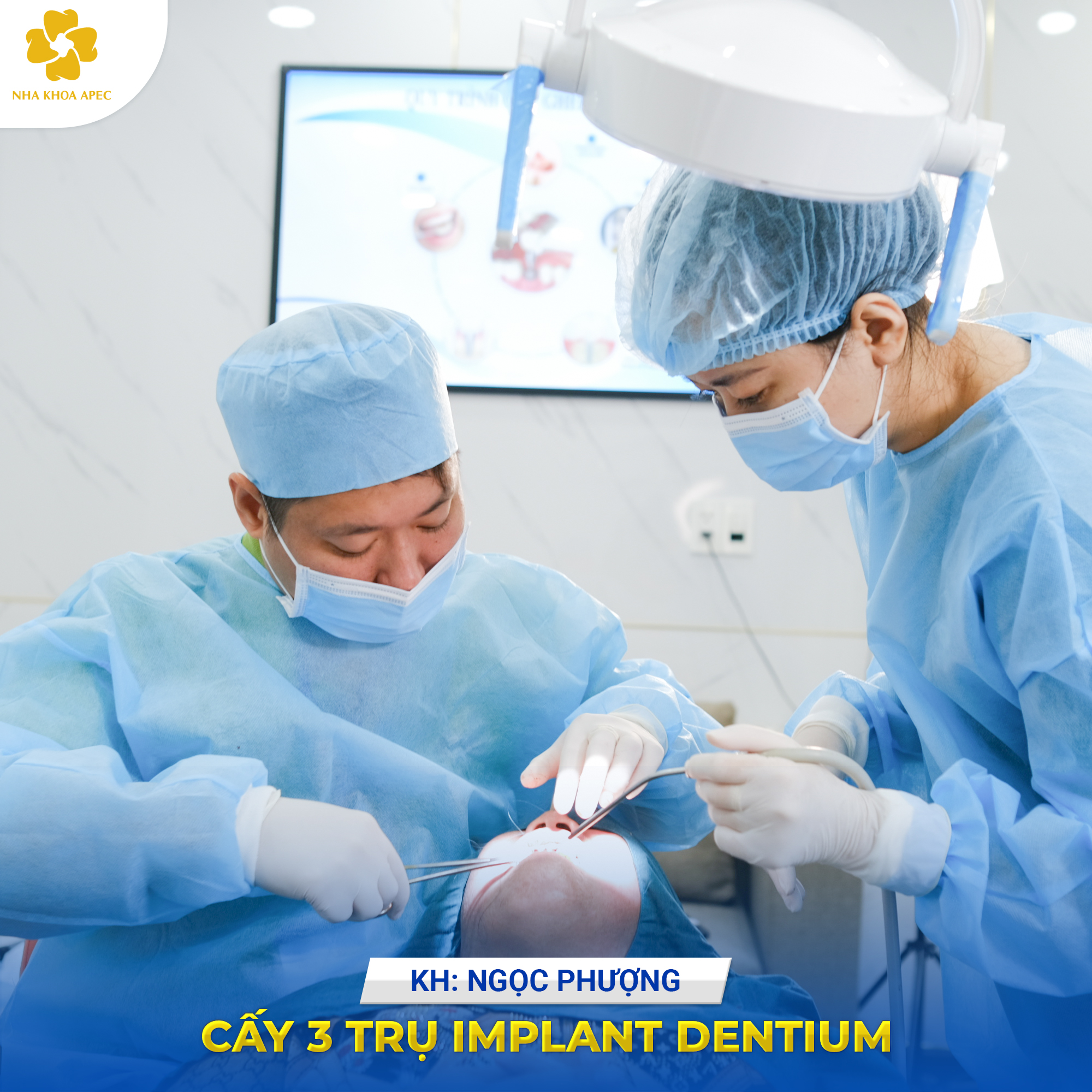 trồng răng Implant